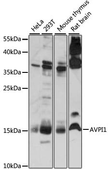 Western blot analysis of extracts of various cell lines, using Anti-AVPI1 Antibody (A15497) at 1:1,000 dilution.
Secondary antibody: Goat Anti-Rabbit IgG (H+L) (HRP) (AS014) at 1:10,000 dilution.
Lysates / proteins: 25µg per lane.
Blocking buffer: 3% non-fat dry milk in TBST.
Detection: ECL Basic Kit (RM00020).
Exposure time: 30s.