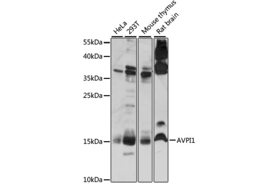 Western Blot - Anti-AVPI1 Antibody (A88535) - Antibodies.com
