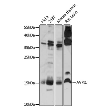 Western Blot - Anti-AVPI1 Antibody (A88535) - Antibodies.com