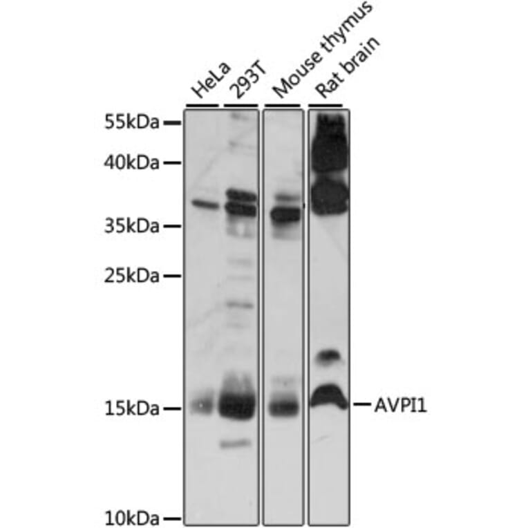Western Blot - Anti-AVPI1 Antibody (A88535) - Antibodies.com