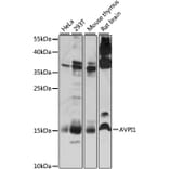 Western Blot - Anti-AVPI1 Antibody (A88535) - Antibodies.com