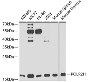 Western Blot - Anti-POLR2H Antibody (A88536) - Antibodies.com