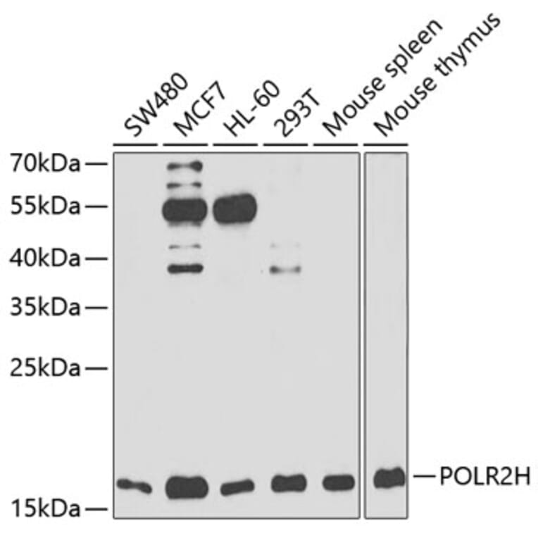Western Blot - Anti-POLR2H Antibody (A88536) - Antibodies.com