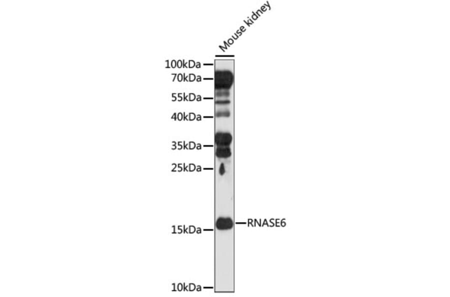 Western Blot - Anti-RNASE6 Antibody (A88537) - Antibodies.com
