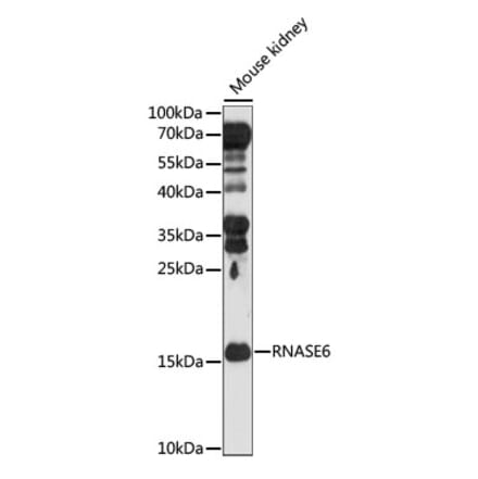 Western Blot - Anti-RNASE6 Antibody (A88537) - Antibodies.com