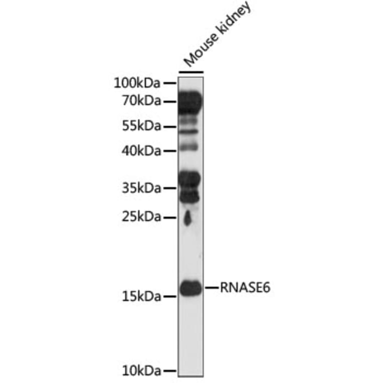 Western Blot - Anti-RNASE6 Antibody (A88537) - Antibodies.com