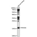 Western Blot - Anti-RNASE6 Antibody (A88537) - Antibodies.com