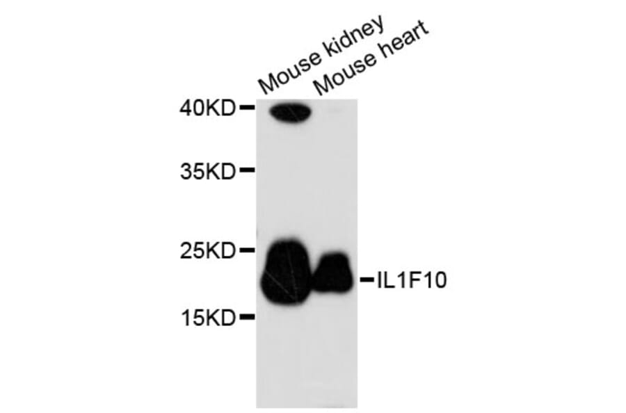 Western Blot - Anti-IL1F10 Antibody (A13133) - Antibodies.com