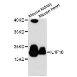 Western Blot - Anti-IL1F10 Antibody (A13133) - Antibodies.com