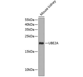 Western Blot - Anti-Rad6 Antibody (A88539) - Antibodies.com