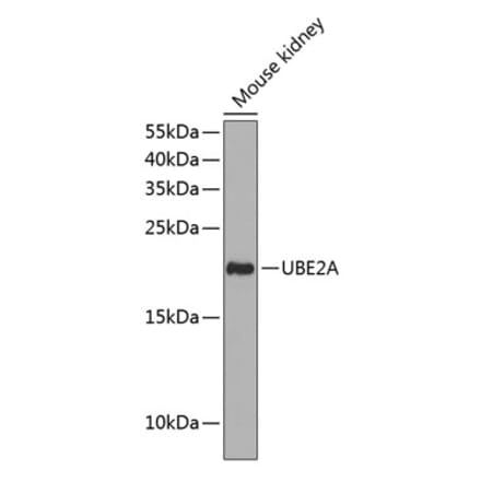 Western Blot - Anti-Rad6 Antibody (A88539) - Antibodies.com