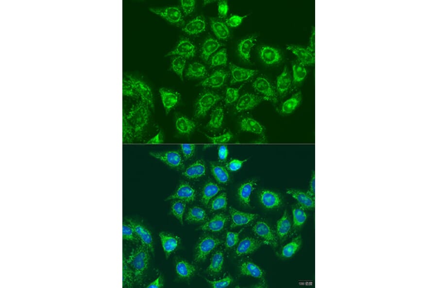 Immunofluorescence - Anti-Rad6 Antibody (A88539) - Antibodies.com