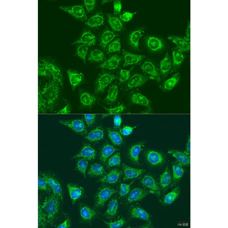 Immunofluorescence - Anti-Rad6 Antibody (A88539) - Antibodies.com