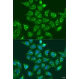 Immunofluorescence - Anti-Rad6 Antibody (A88539) - Antibodies.com