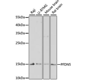 Western Blot - Anti-PFDN5 Antibody (A88540) - Antibodies.com