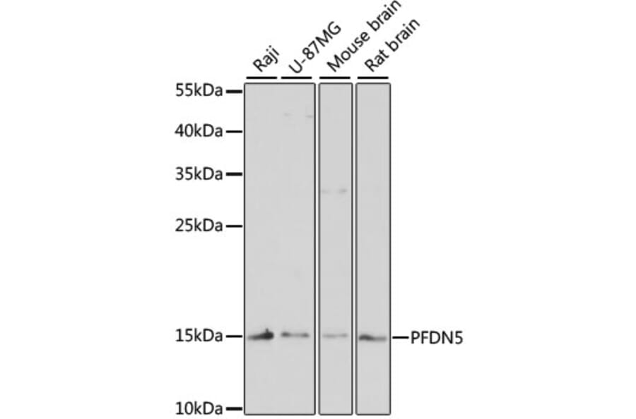 Western Blot - Anti-PFDN5 Antibody (A88540) - Antibodies.com