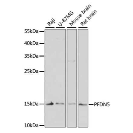 Western Blot - Anti-PFDN5 Antibody (A88540) - Antibodies.com