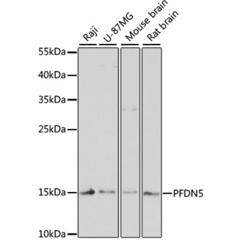 Western Blot - Anti-PFDN5 Antibody (A88540) - Antibodies.com