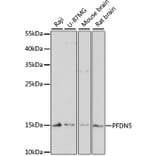 Western Blot - Anti-PFDN5 Antibody (A88540) - Antibodies.com