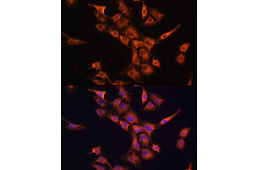 Immunofluorescence - Anti-PFDN5 Antibody (A88540) - Antibodies.com