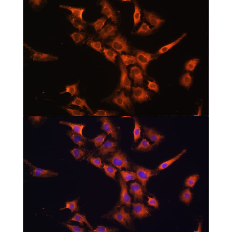 Immunofluorescence - Anti-PFDN5 Antibody (A88540) - Antibodies.com