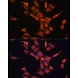Immunofluorescence - Anti-PFDN5 Antibody (A88540) - Antibodies.com