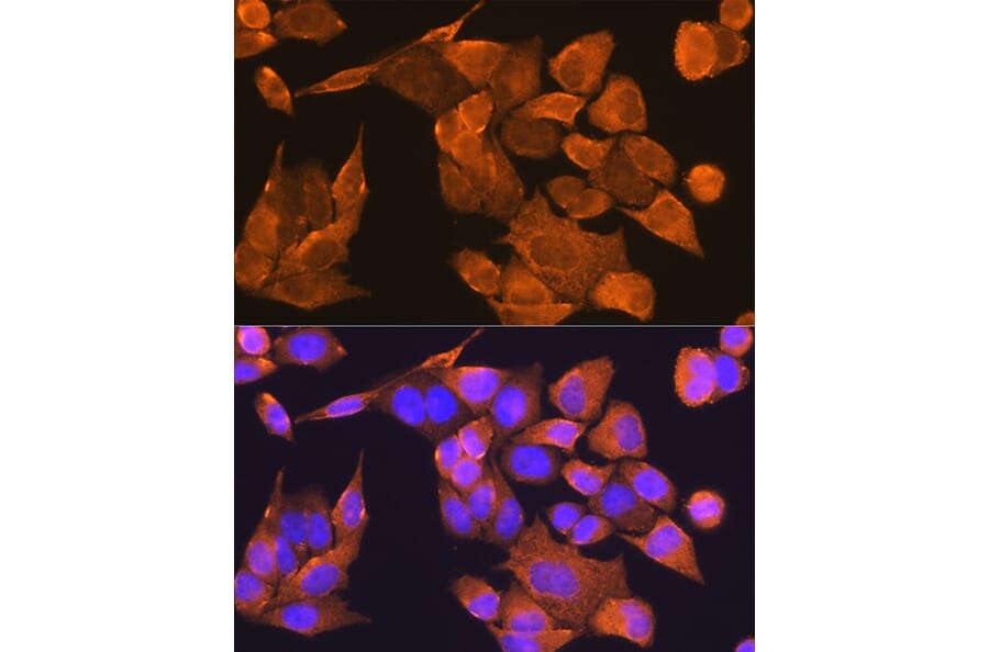 Immunofluorescence - Anti-PFDN5 Antibody (A88540) - Antibodies.com