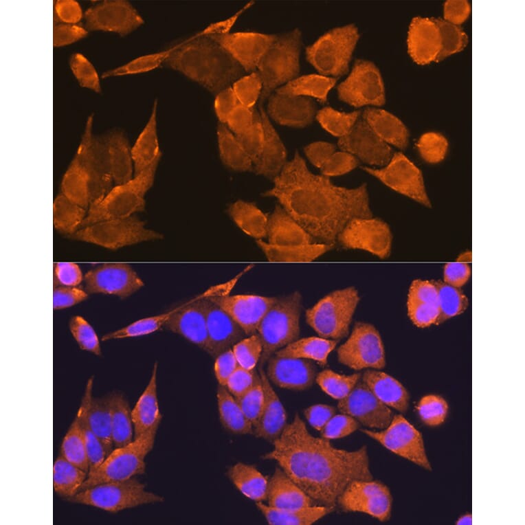 Immunofluorescence - Anti-PFDN5 Antibody (A88540) - Antibodies.com