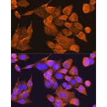 Immunofluorescence - Anti-PFDN5 Antibody (A88540) - Antibodies.com