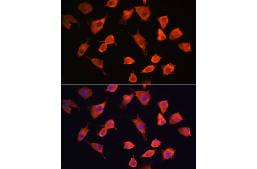 Immunofluorescence - Anti-PFDN5 Antibody (A88540) - Antibodies.com