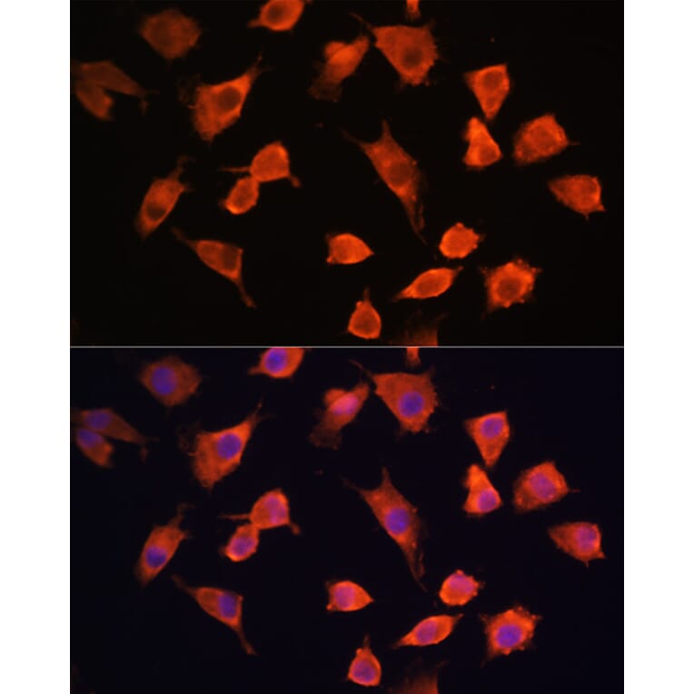 Immunofluorescence - Anti-PFDN5 Antibody (A88540) - Antibodies.com
