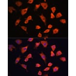 Immunofluorescence - Anti-PFDN5 Antibody (A88540) - Antibodies.com
