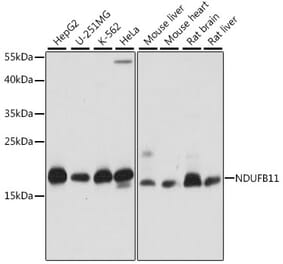 Western Blot - Anti-NDUFB11 Antibody (A88541) - Antibodies.com