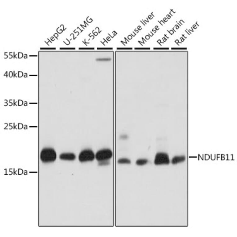 Western Blot - Anti-NDUFB11 Antibody (A88541) - Antibodies.com