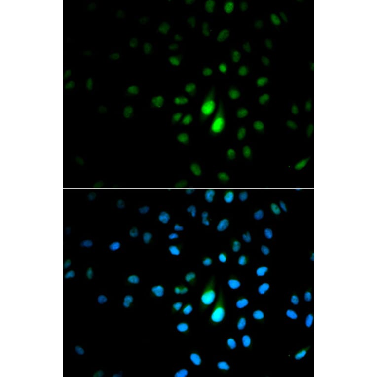 Immunofluorescence - Anti-Pin1 Antibody (A88542) - Antibodies.com
