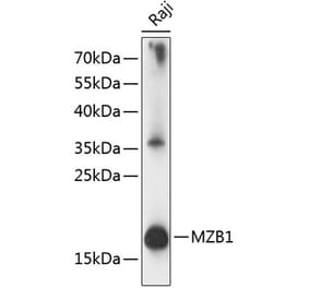 Western Blot - Anti-PACAP Antibody (A88543) - Antibodies.com