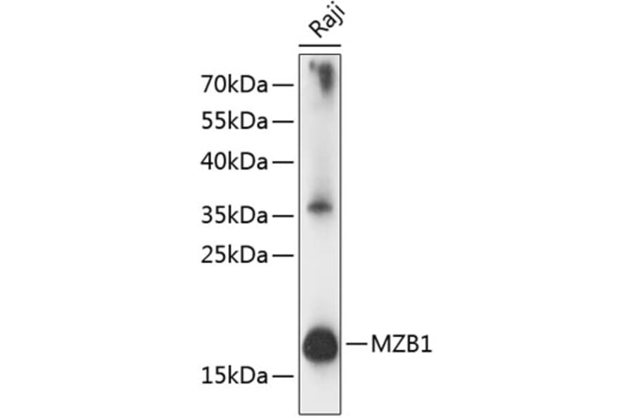 Western Blot - Anti-PACAP Antibody (A88543) - Antibodies.com
