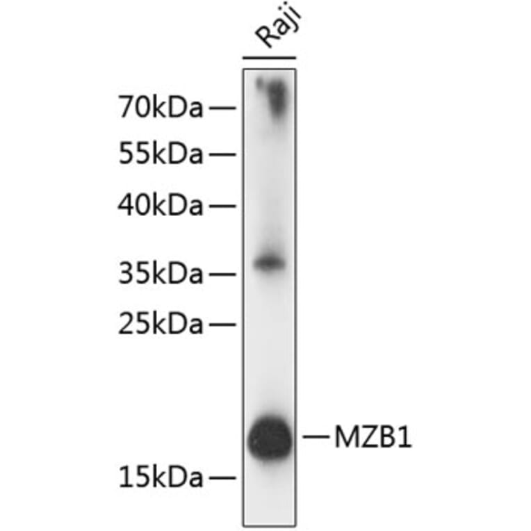 Western Blot - Anti-PACAP Antibody (A88543) - Antibodies.com