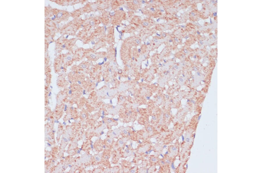 Immunohistochemistry - Anti-PACAP Antibody (A88543) - Antibodies.com