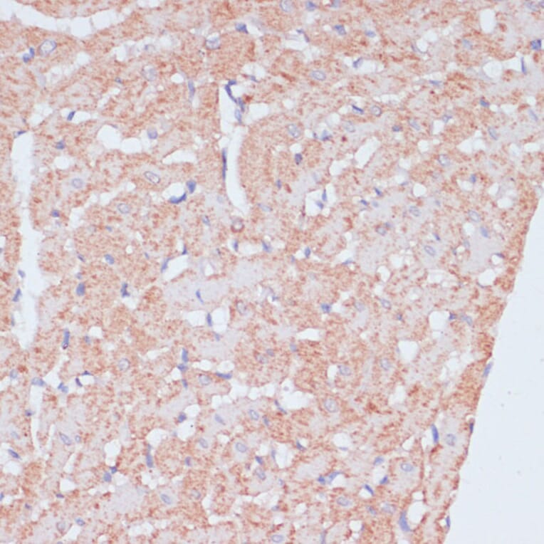 Immunohistochemistry - Anti-PACAP Antibody (A88543) - Antibodies.com