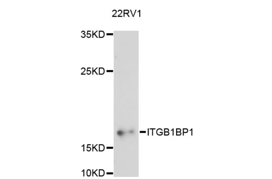 Western Blot - Anti-ITGB1BP1 Antibody (A13061) - Antibodies.com