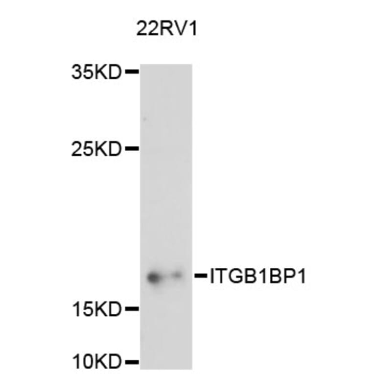 Western Blot - Anti-ITGB1BP1 Antibody (A13061) - Antibodies.com