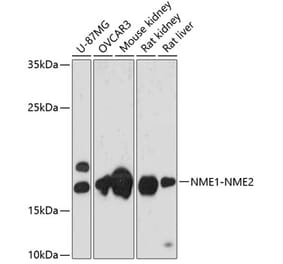 Western Blot - Anti-NME2 Antibody (A88545) - Antibodies.com