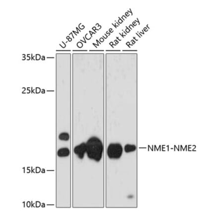 Western Blot - Anti-NME2 Antibody (A88545) - Antibodies.com