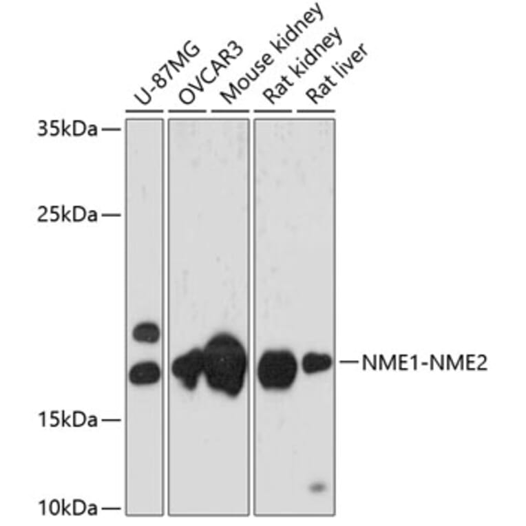 Western Blot - Anti-NME2 Antibody (A88545) - Antibodies.com