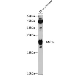 Western Blot - Anti-GMFG Antibody (A88546) - Antibodies.com