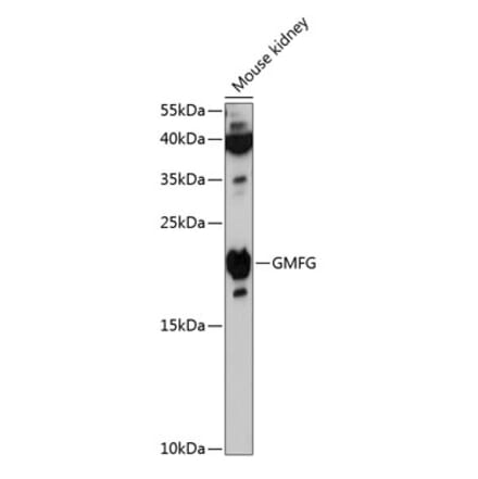 Western Blot - Anti-GMFG Antibody (A88546) - Antibodies.com