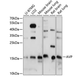 Western Blot - Anti-Vasopressin Antibody (A88548) - Antibodies.com