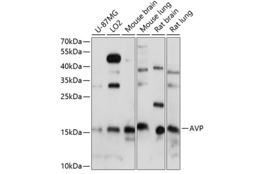 Western Blot - Anti-Vasopressin Antibody (A88548) - Antibodies.com