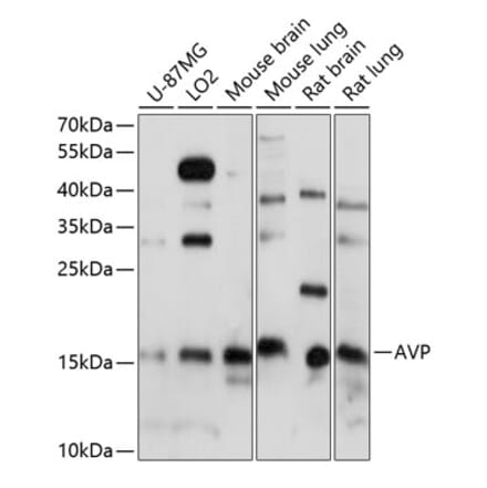 Western Blot - Anti-Vasopressin Antibody (A88548) - Antibodies.com